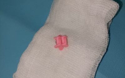 В Якутии четырехлетний ребенок поперхнулся заколкой для волос