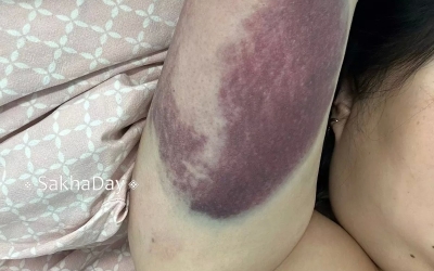 "Я подумаю": Энжи утверждает, что избивший ее парень хочет откупиться деньгами