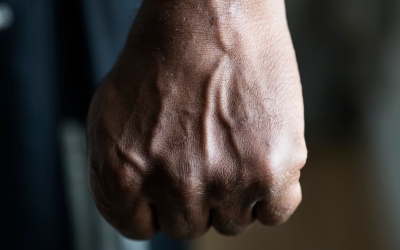 В Якутске вынесен приговор мужчине, который жестоко избил незнакомца и сломал ему кости черепа