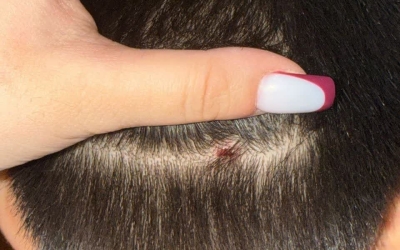 МВД Якутии прокомментировало нападение 8-летнего мальчика на сверстника с ножом в подъезде