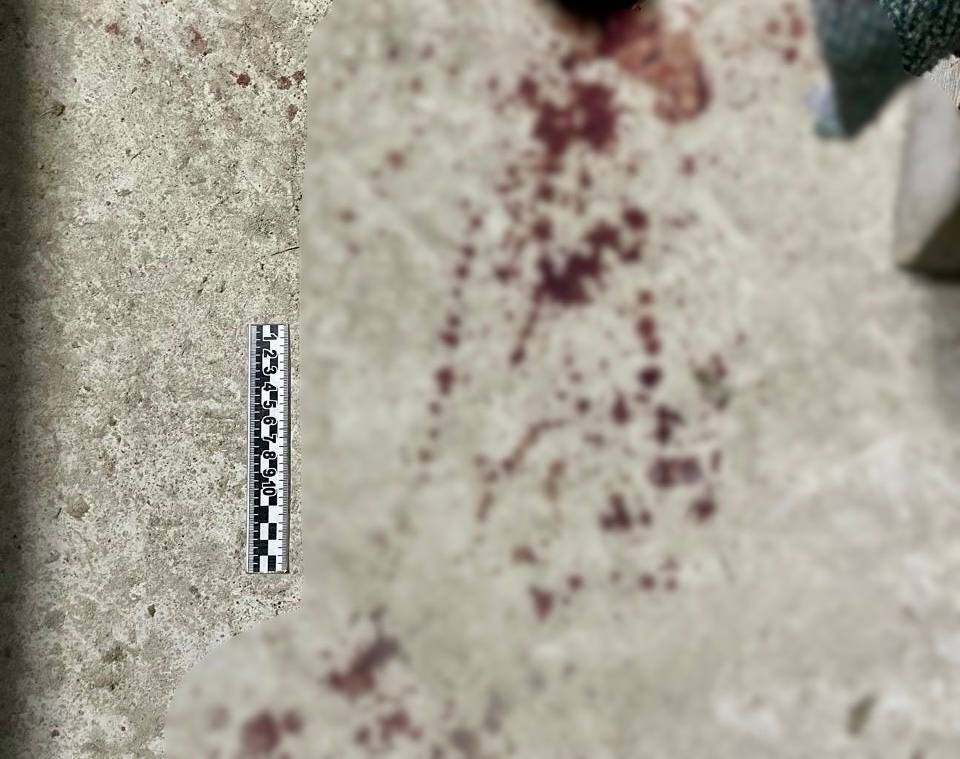 Ссора из-за девушки привела к убийству: 27-летний якутянин убил знакомого ударами трубы по голове